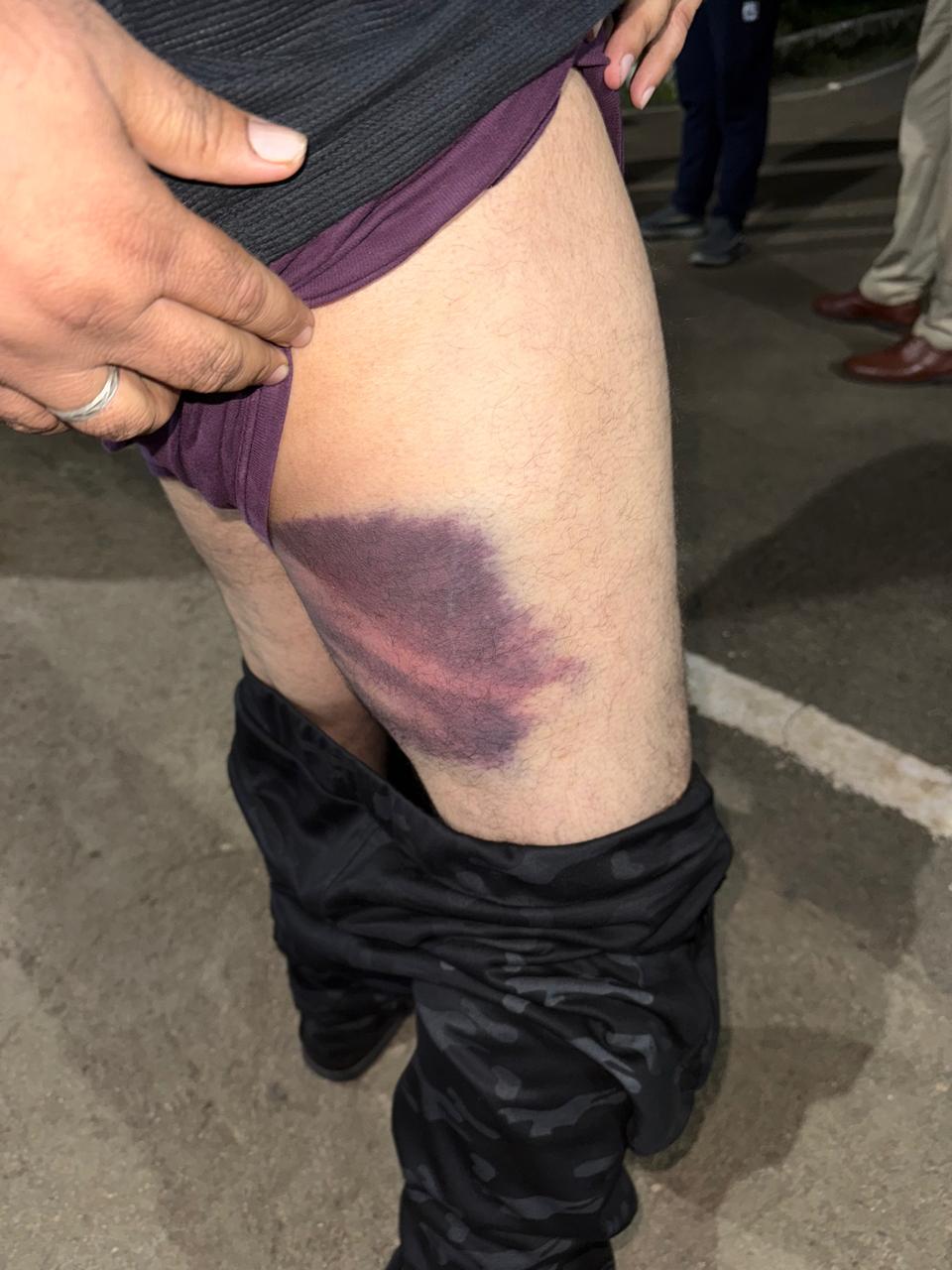 हाईकोर्ट के आदेश से कारोबारी की रिहाई, पुलिस पर पिटाई के गंभीर आरोप 3 1760532159 WhatsApp Image 2025 10 15 at 5.42.45 PM